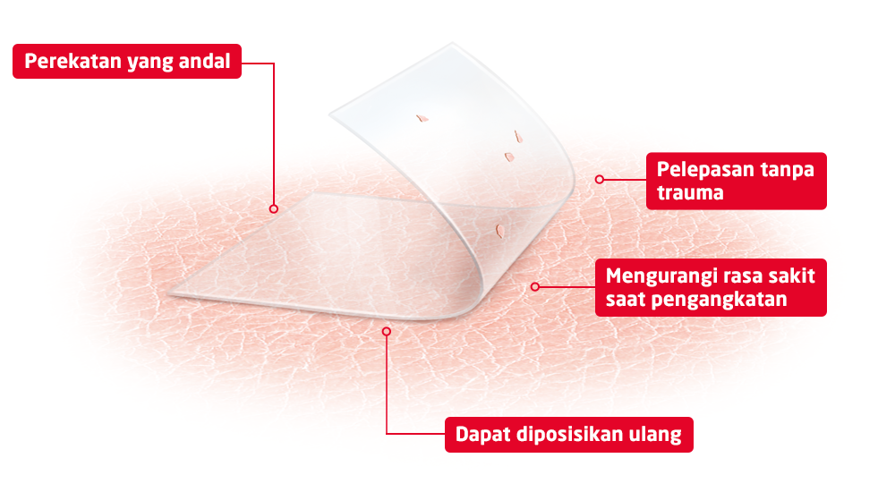 Foto produk yang memperlihatkan manfaat teknologi skin sensitive: perekatan yang andal, mengurangi rasa sakit saat dilepaskan, pelepasan tanpa menimbulkan trauma, dan dapat diubah posisinya Foto produk yang memperlihatkan manfaat teknologi skin sensitive: perekatan yang andal, mengurangi rasa sakit saat dilepaskan, pelepasan tanpa menimbulkan trauma, dan dapat diubah posisinya